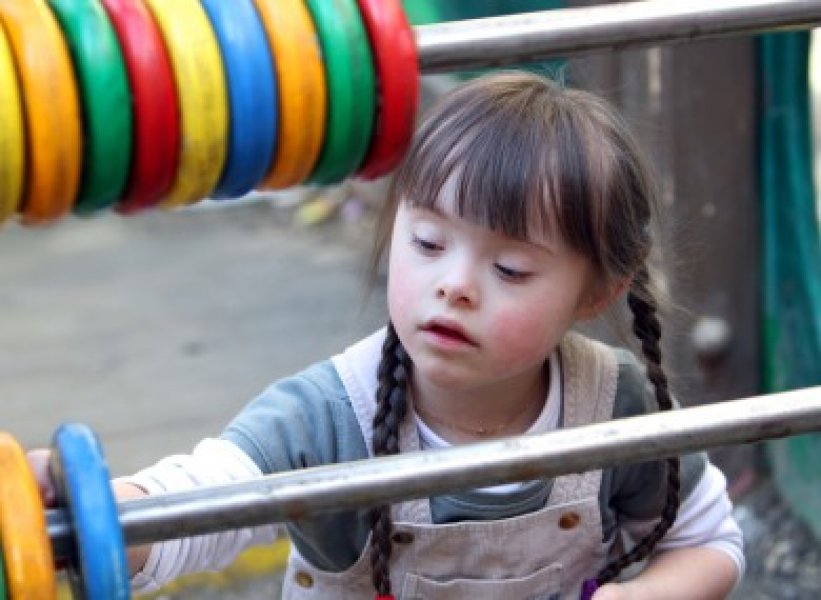 Down Sendromu Nedir?